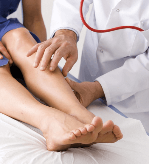 Лечение варикоза 1